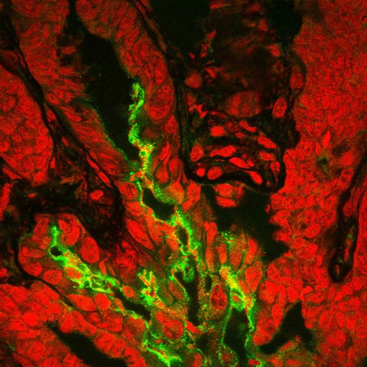 Pioneering prebiotics for improved gut health